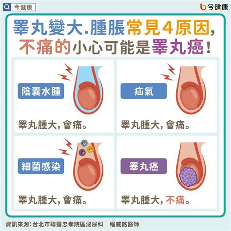 蛋蛋長肉芽|健康網》「蛋蛋」的哀傷！ 醫揭4大常見睪丸病症